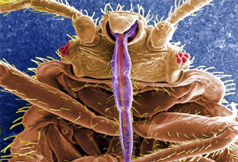 closeup of a bedbug