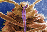 closeup of a bedbug