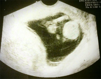 Sonogram